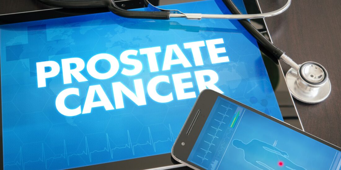 Radiation treatment for prostate cancer in Kansas City
